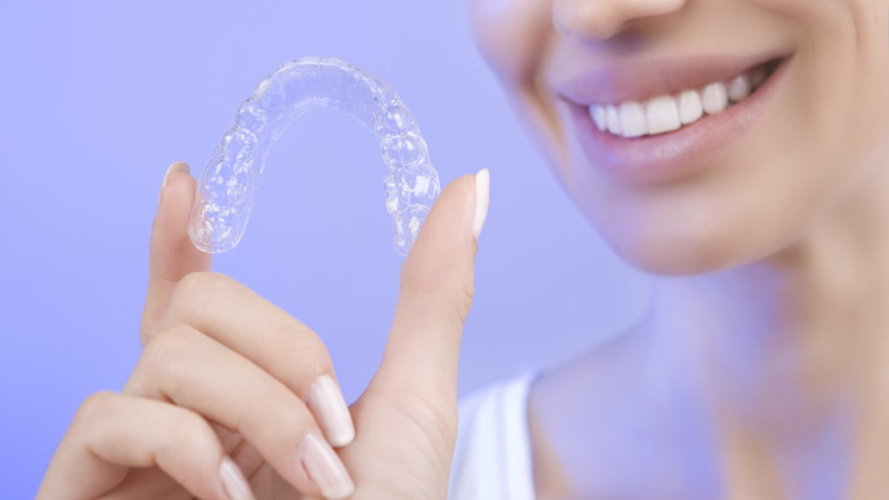 Active Aligners clear aligners review