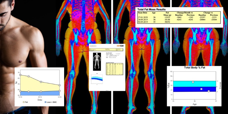 DEXA Scan 